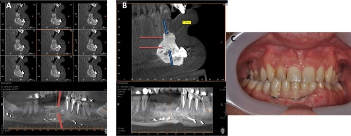 FIGURE 6