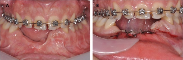 FIGURE 4