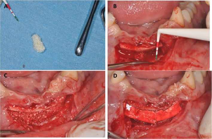 FIGURE 3