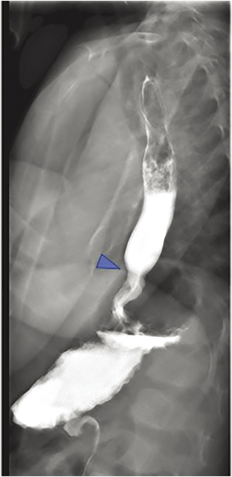 Fig. 4