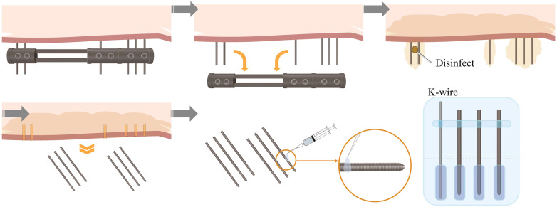 Figure 3