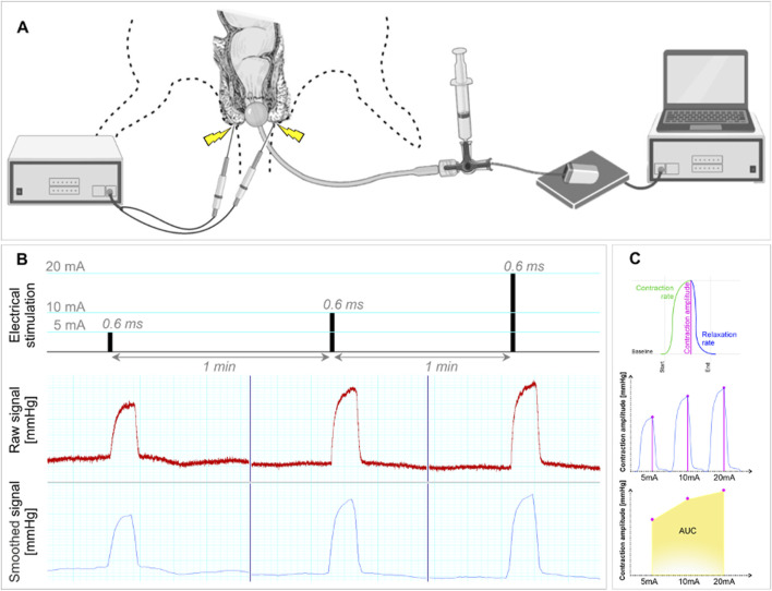 FIGURE 2