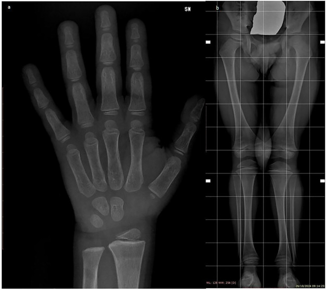 Figure 2