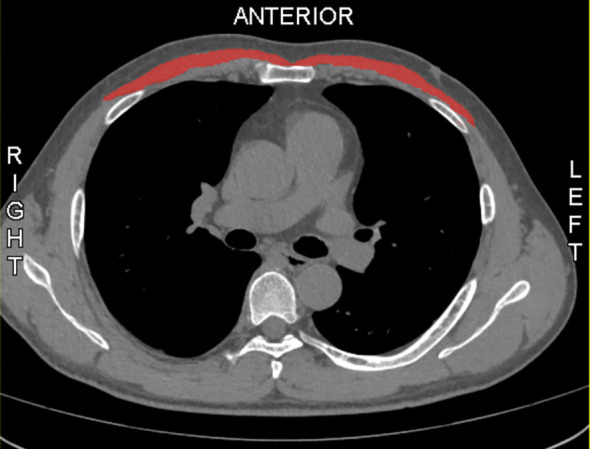 Figure 1
