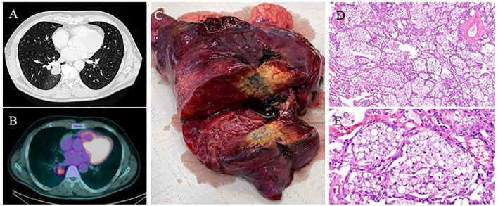 Figure 4