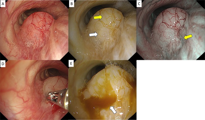 FIGURE 5