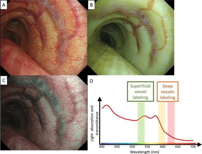 FIGURE 4