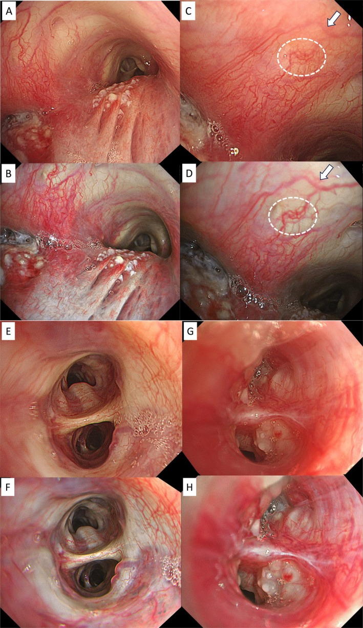 FIGURE 3