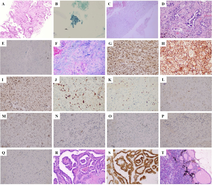 Figure 2