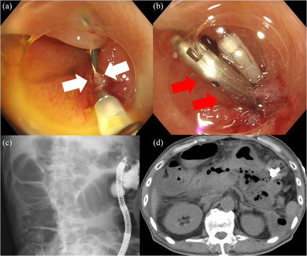 FIGURE 3