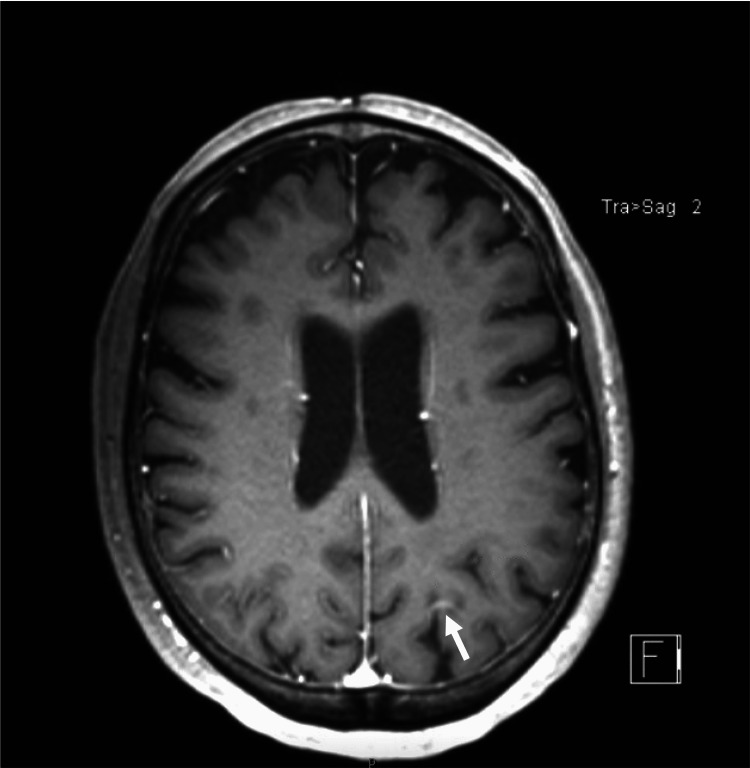 Figure 6