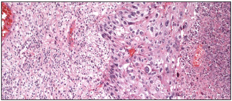 Figure 12