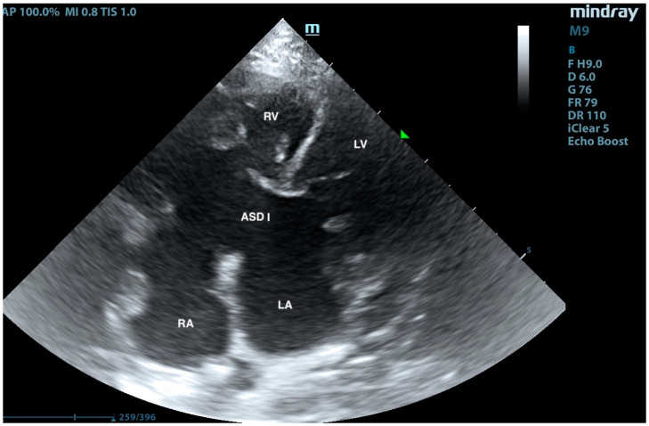 Figure 4