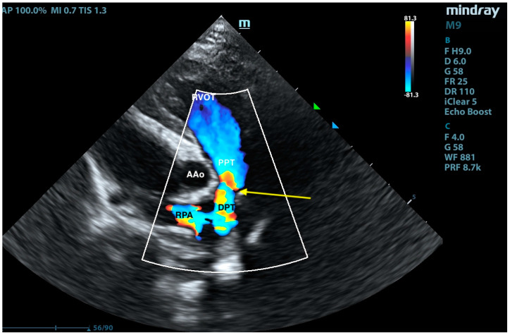 Figure 9
