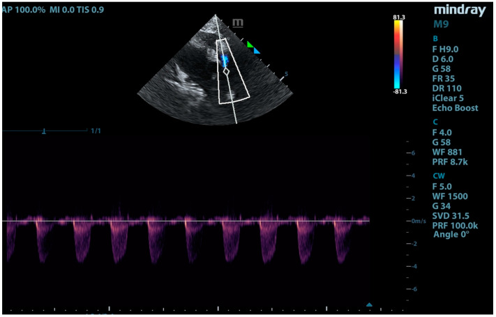 Figure 10