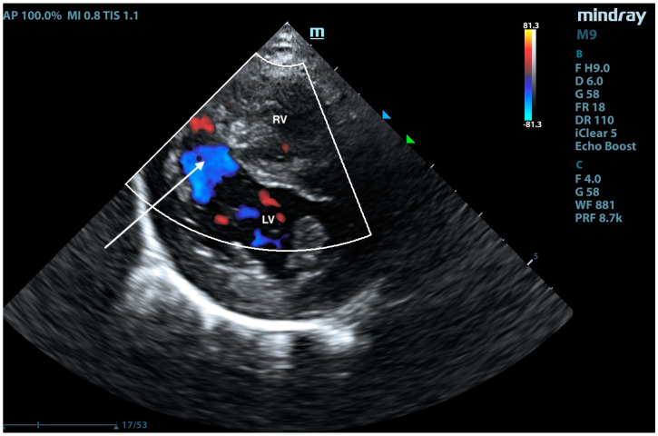 Figure 11