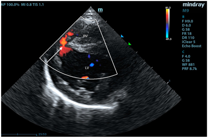 Figure 12