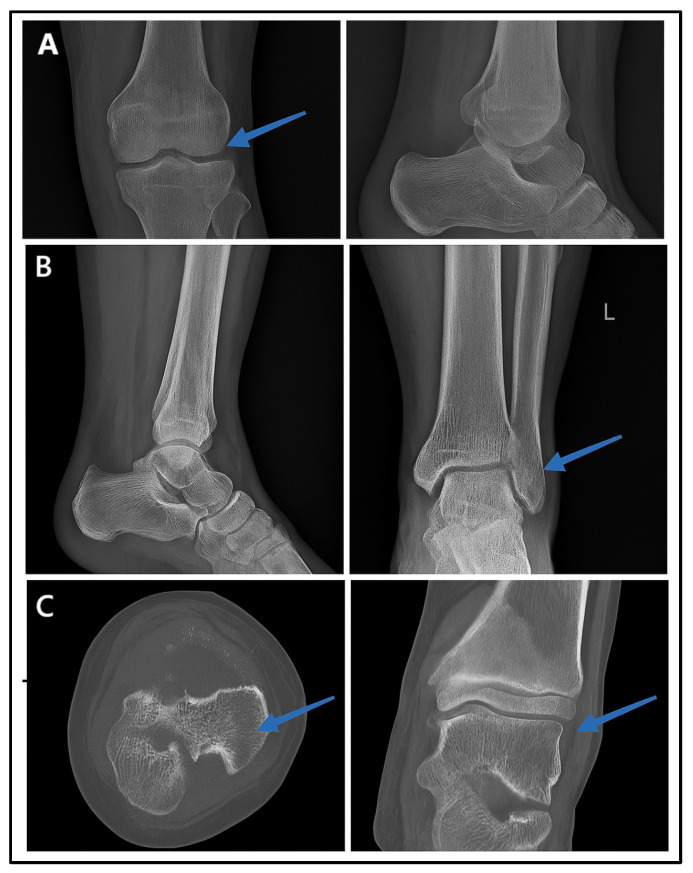Figure 6