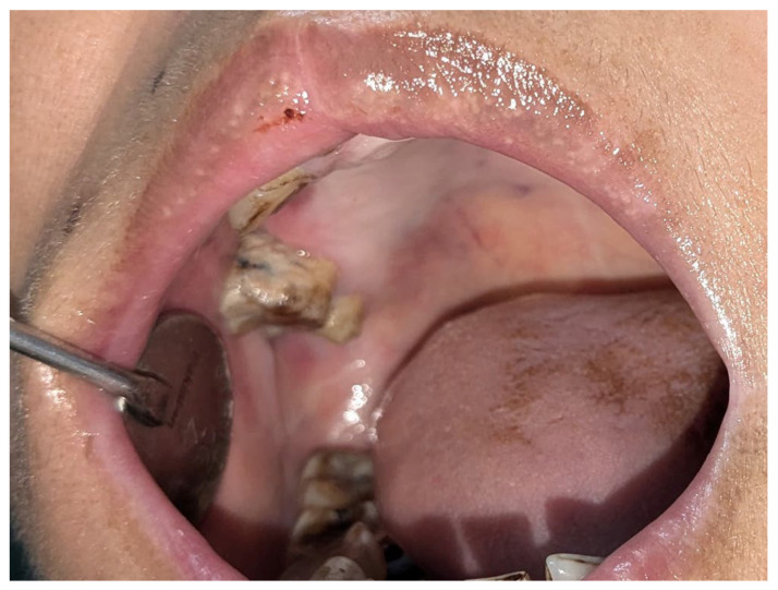 Figure 6