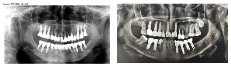 Figure 12