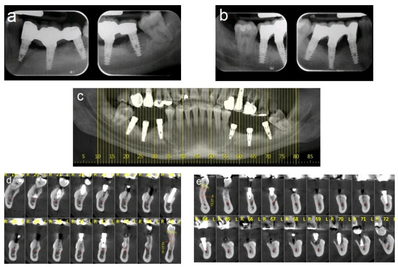Figure 13