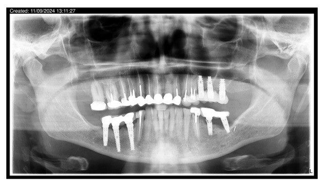 Figure 14