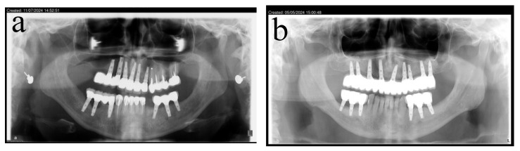 Figure 15