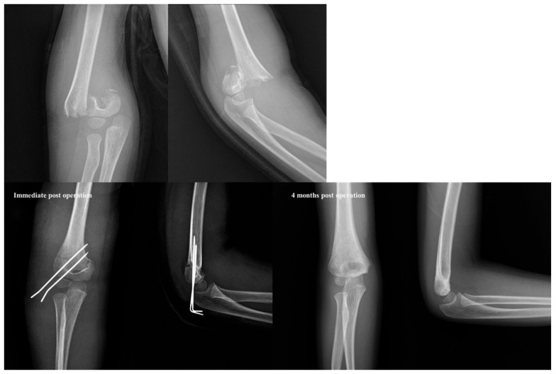 Figure 4