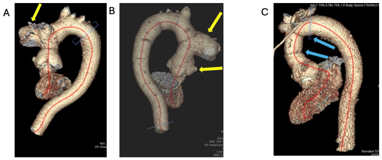 Figure 9