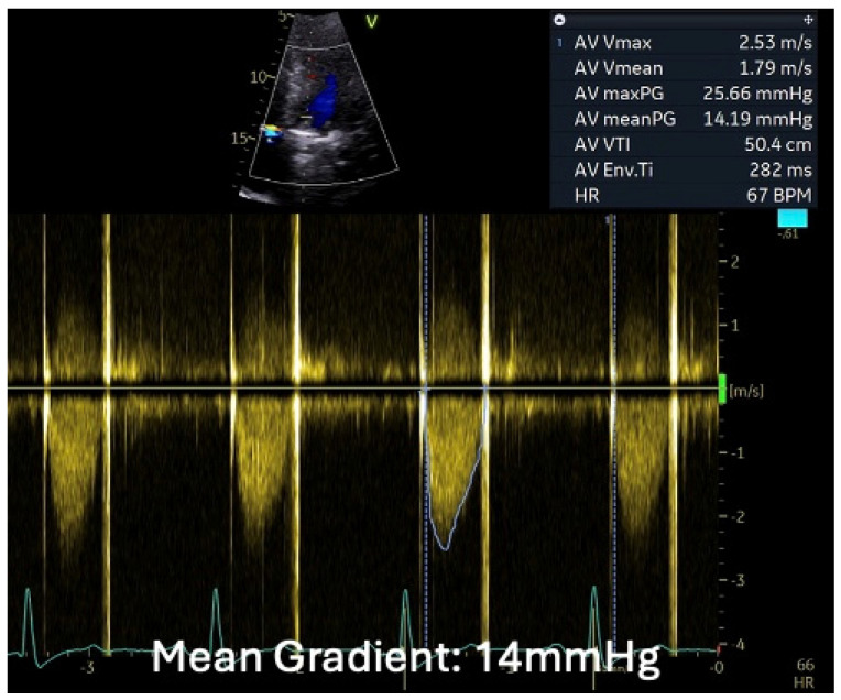 Figure 11