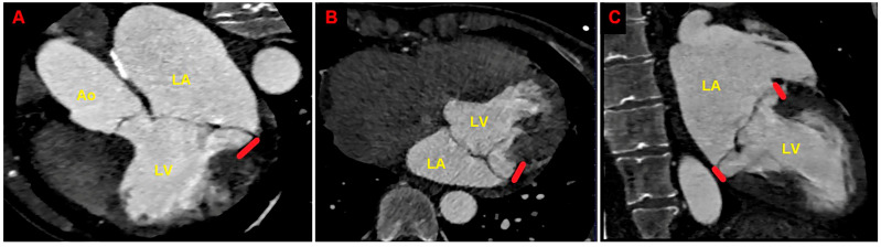 Figure 6