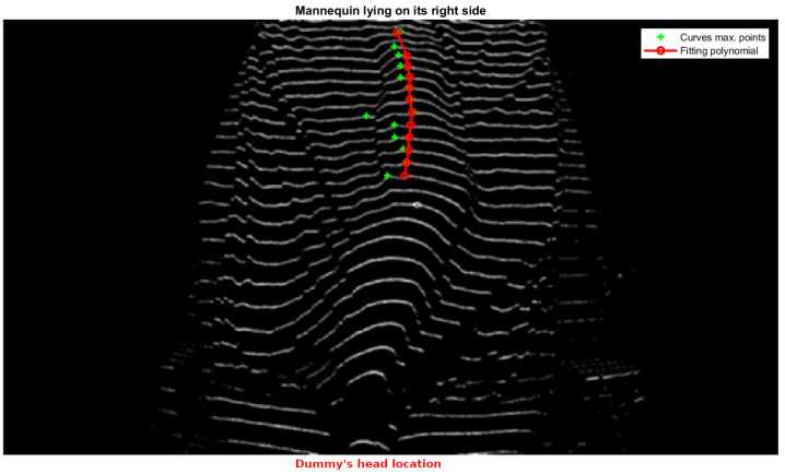 Figure 20