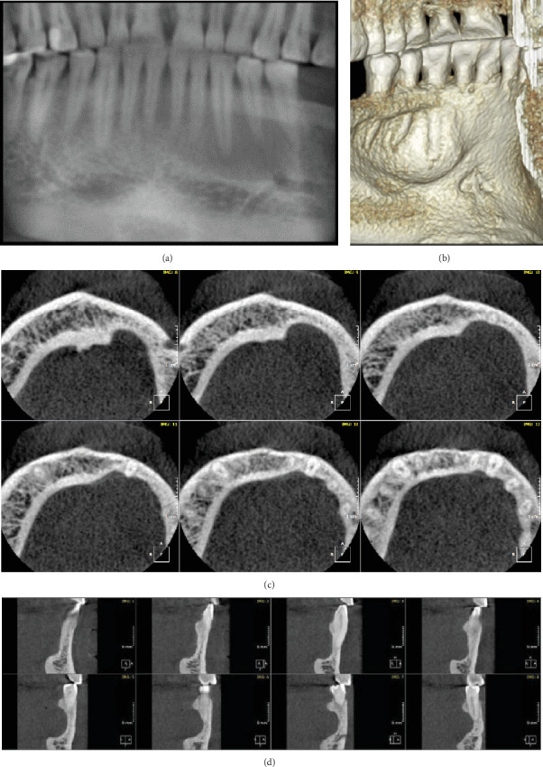 Figure 4
