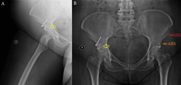 Figure 5