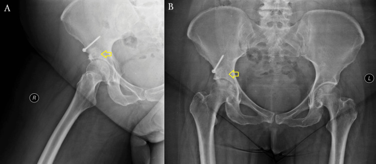 Figure 6