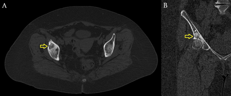 Figure 9