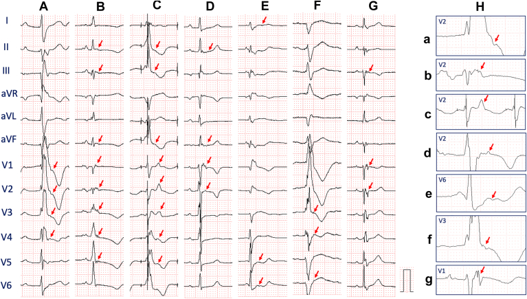 Figure 7