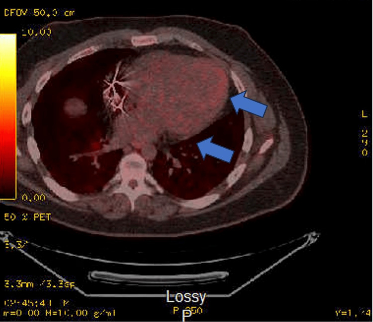 Figure 9