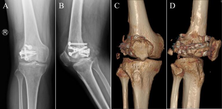 Figure 6