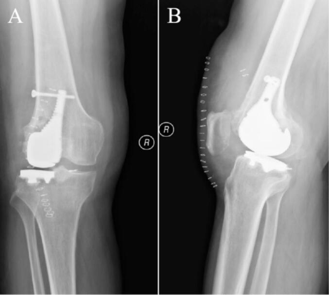 Figure 10