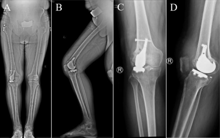 Figure 11