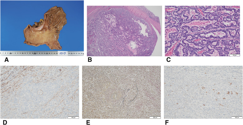 Fig. 6