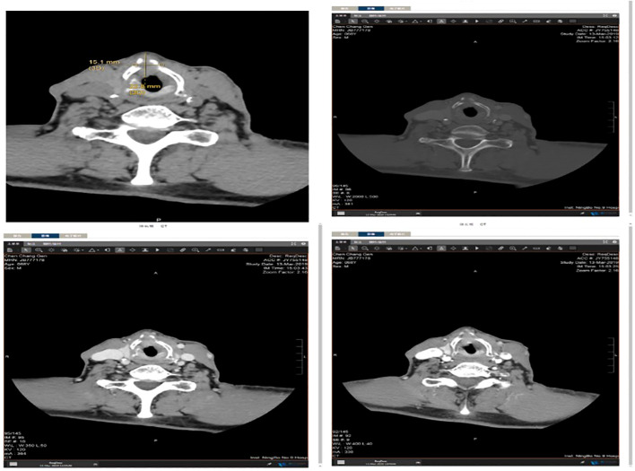 Figure 2