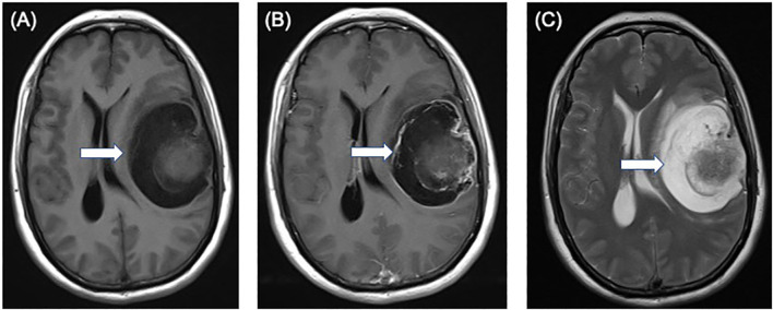 Figure 1