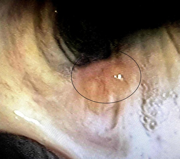 FIGURE 3