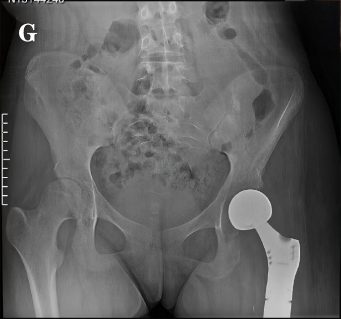 Figure 7