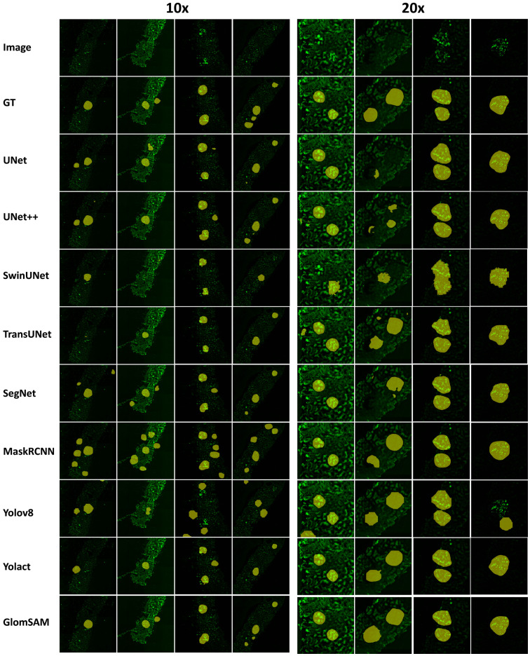 Fig 11