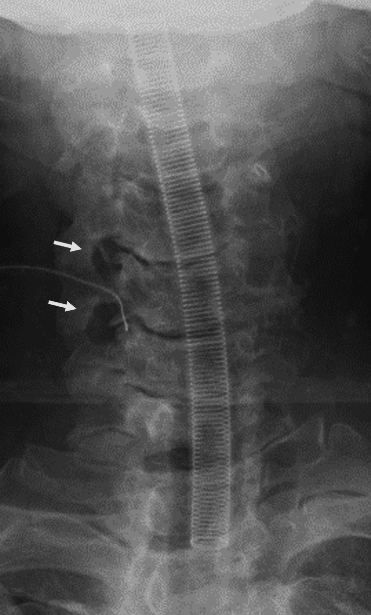 Figure 9