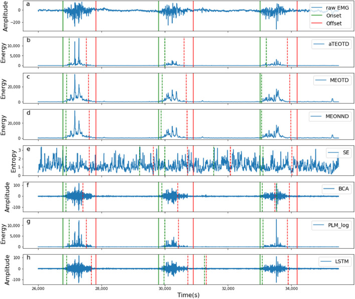 FIGURE 11