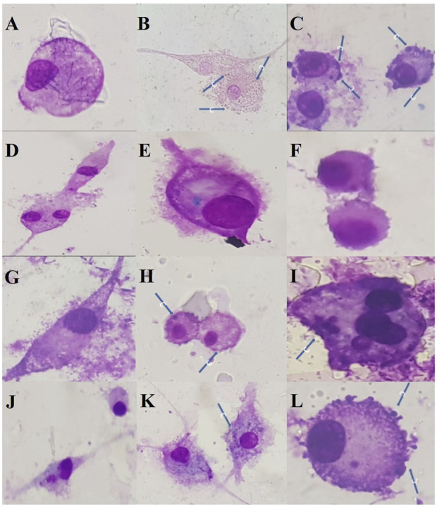 FIGURE 3